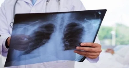 Бір тәулікте 241 адамнан коронавирус пен пневмония анықталды